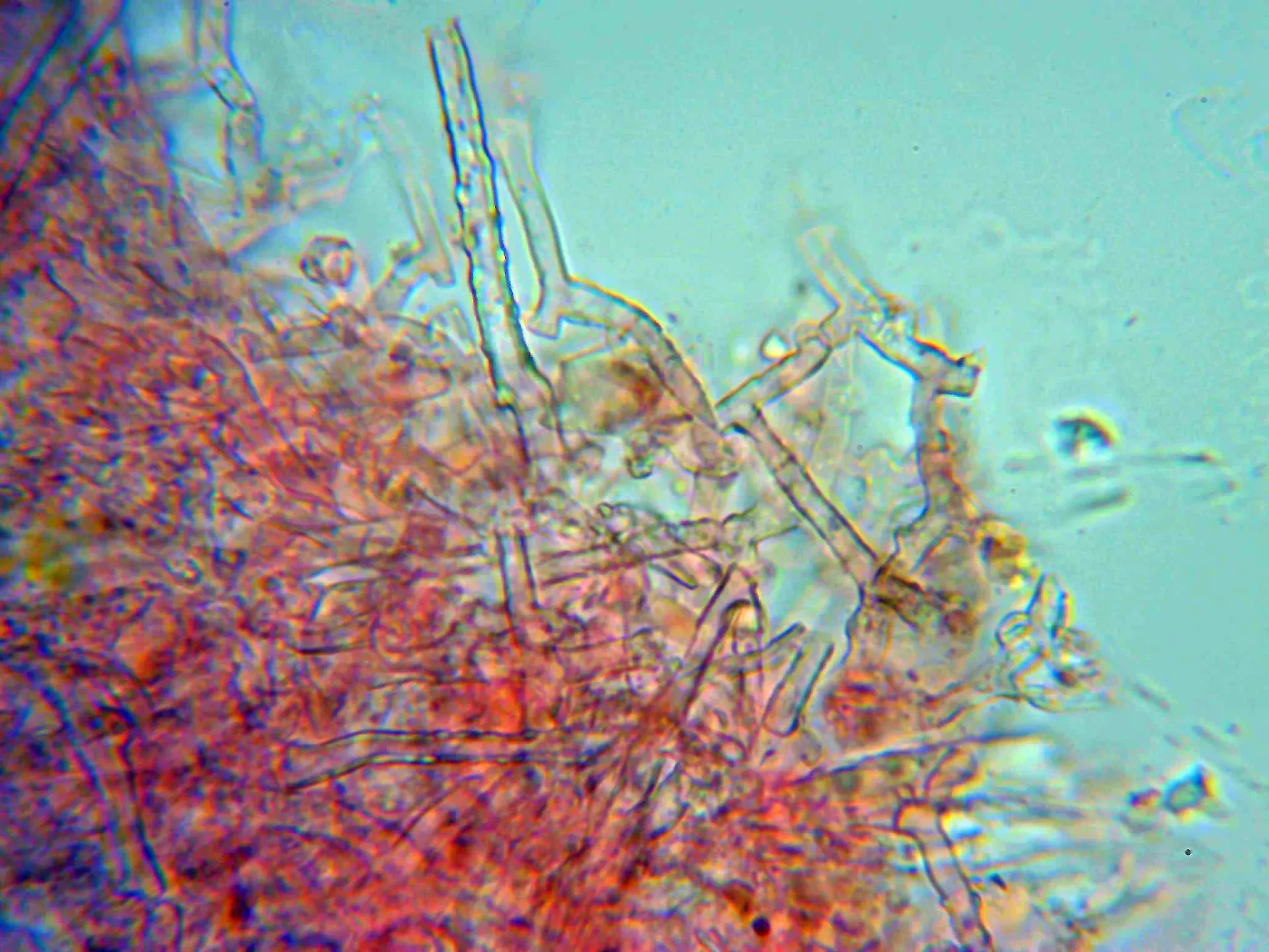 Microscopía de Subulicystidium brachysporum - 14 - Hifas ramificadas y fibuladas